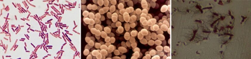 Escherichia coli, enterococcus fecal e proteus son os principais axentes causantes da prostatite bacteriana crónica