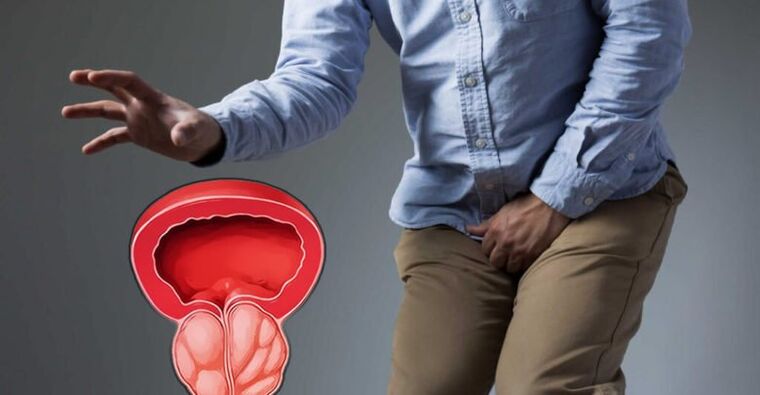 Prevención de prostatite e adenoma de próstata